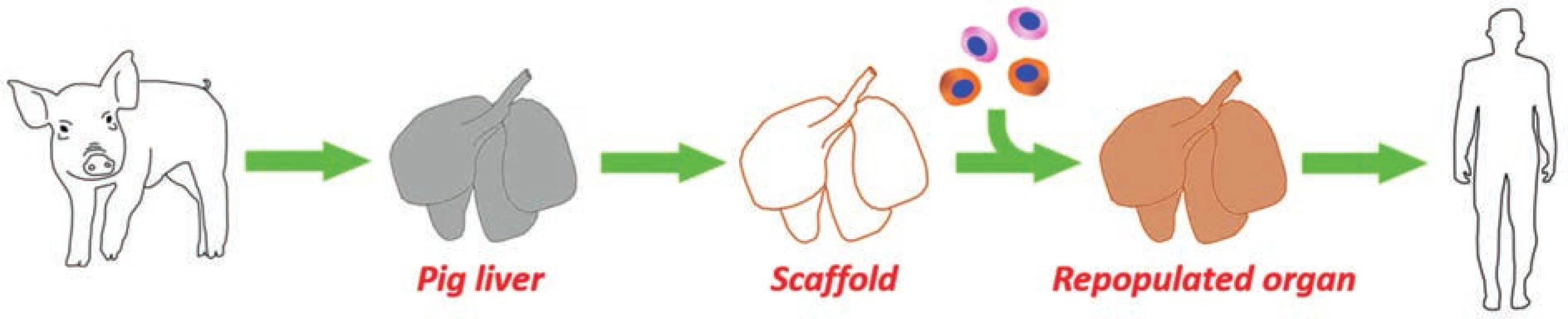 Vize využití decelularizovaných prasečích jater k přípravě humanizovaného graftu vhodného pro transplantaci<br>
Fig. 1: Vision to employ decellularized pig livers for constructing humanized grafts suitable for liver transplantation