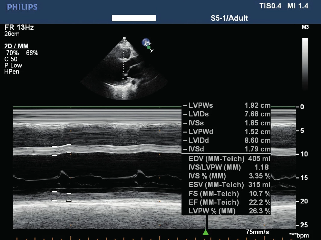 Echokardiogram