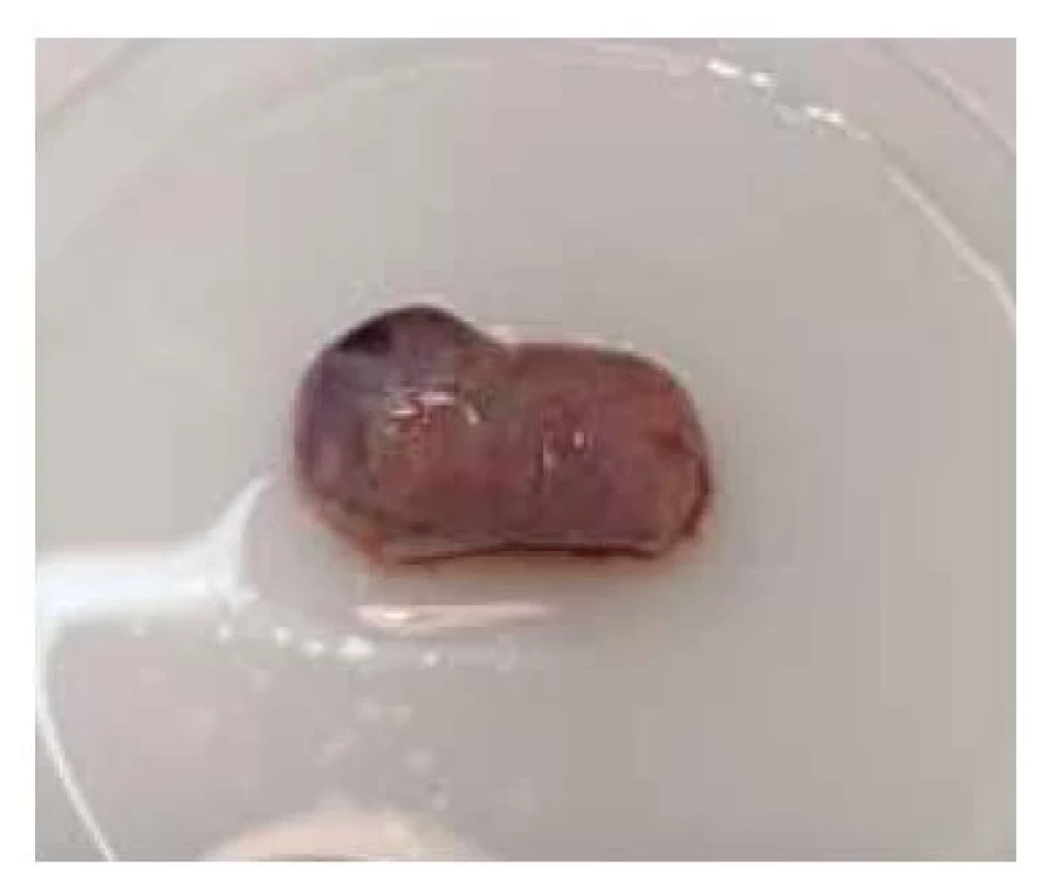 Ovarium.<br>
Fig. 3. Ovary.