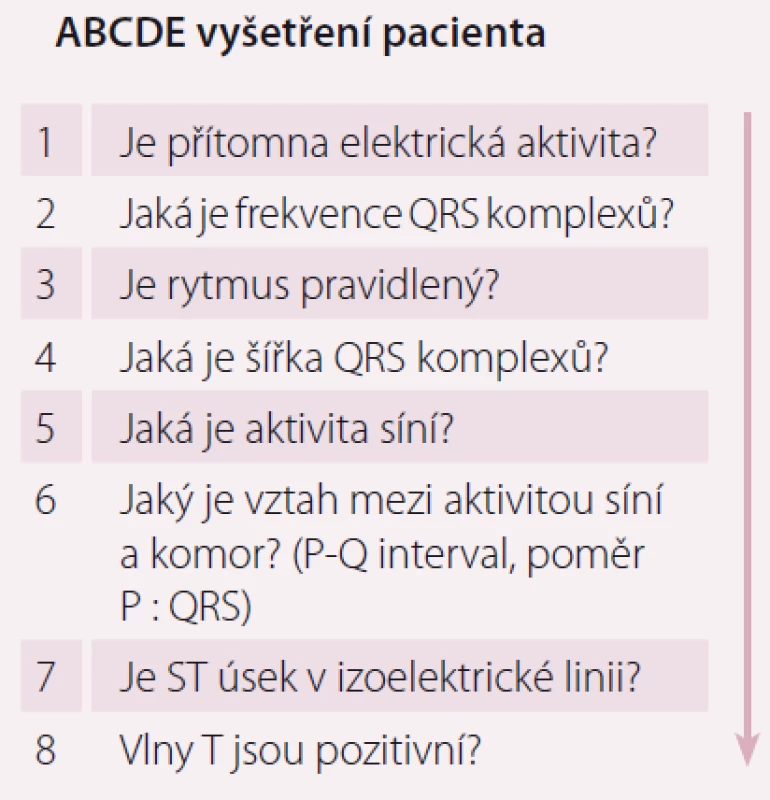 Zjednodušená podoba
EKG diagnostiky v osmi krocích.