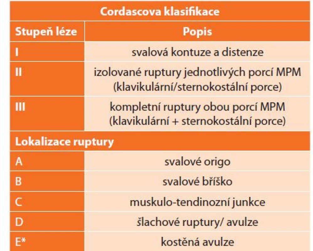 Cordascova klasifikace poranění m. pectoralis major,
převzato z [22]<br>
Tab. 1: Cordasco classification of pectoralis major injuries,
reprinted from [22]