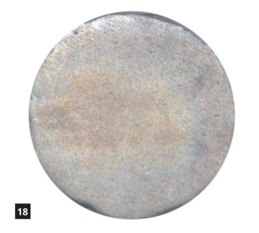 Amalgám vystavený kyselému pH po dobu 14 dnů<br>
Fig. 18 Amalgam exposed to acidic pH for 14 day