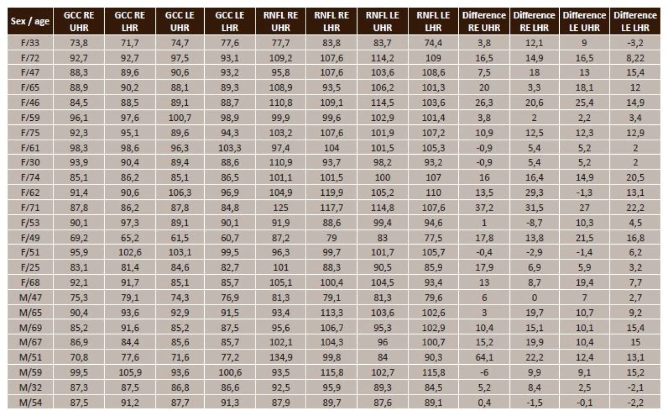 Summary table of measured values in NTG (F/33 = female/33 years, M/47 = male/47 years, GCC = ganglion cell complex, RE = right eye, LE = left eye, UHR = upper half of retina, LHR = lower half of retina, RNFL = retinal nerve fibre layer, Difference = RNFL-GCC