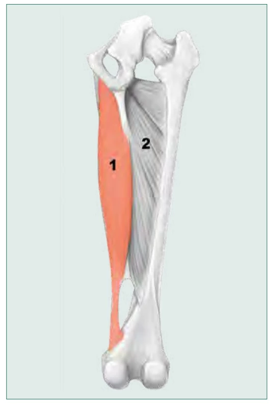 Schematický obraz obou částí m. adductor magnus. 1. ischiokondylární
část inervovaná tibiálními větvemi n. ischiadicus, 2. pubofemorální
část inervovaná zadní větví n. obturatorius