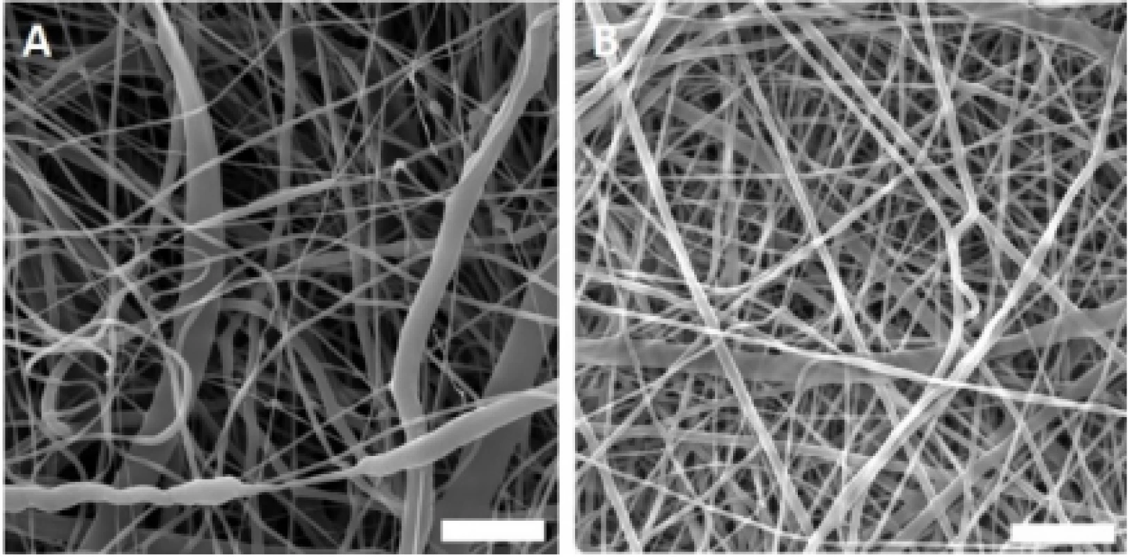 Scanning electron microscopy images of the
fabricated nanofibrous samples. A – PCL, B – PVA.
Magnification 10,000×; scale bar 5 µm.