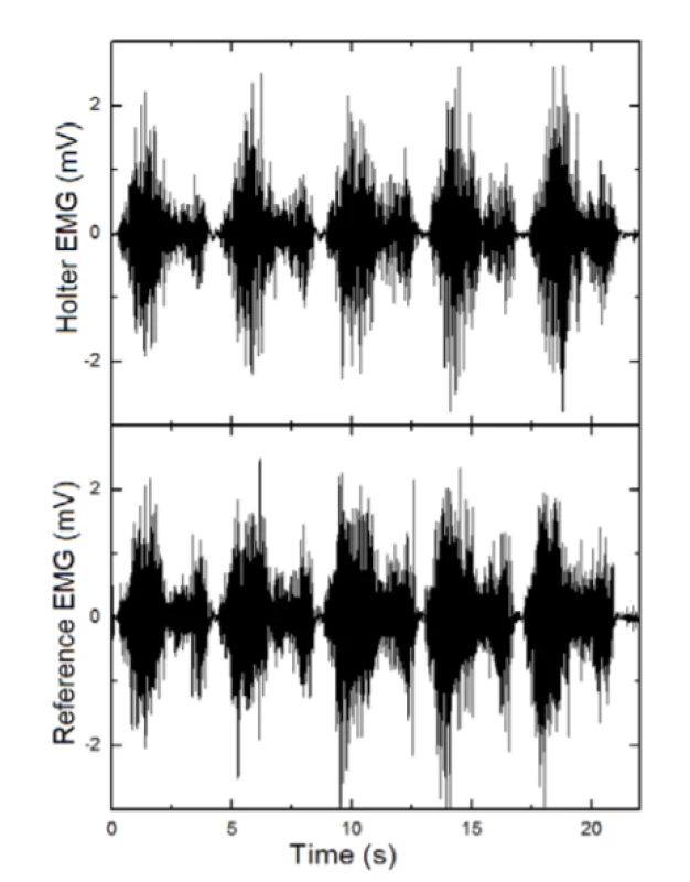 EMG =f(t) - Holter signal comparison with
reference device Neuro-MEP.