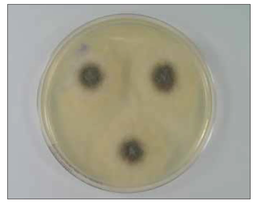 Kultura Mucor sp. na Sabouraudově agaru<br>
(zdroj: Ústav mikrobiologie LF UP a FN Olomouc).