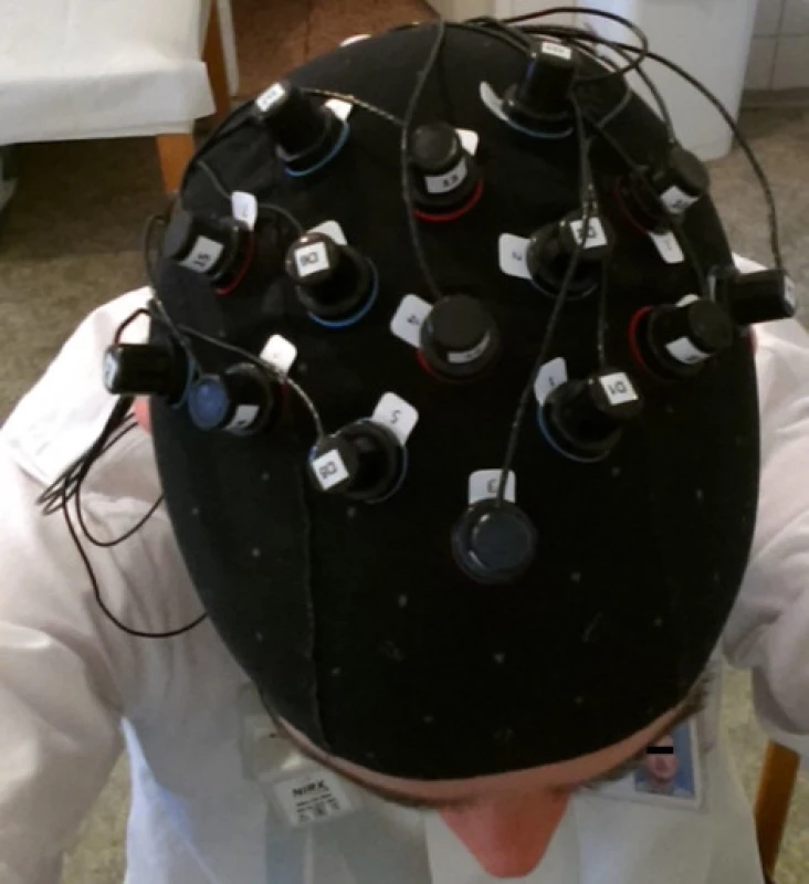 Illustration photo with a NIRS cap placed.