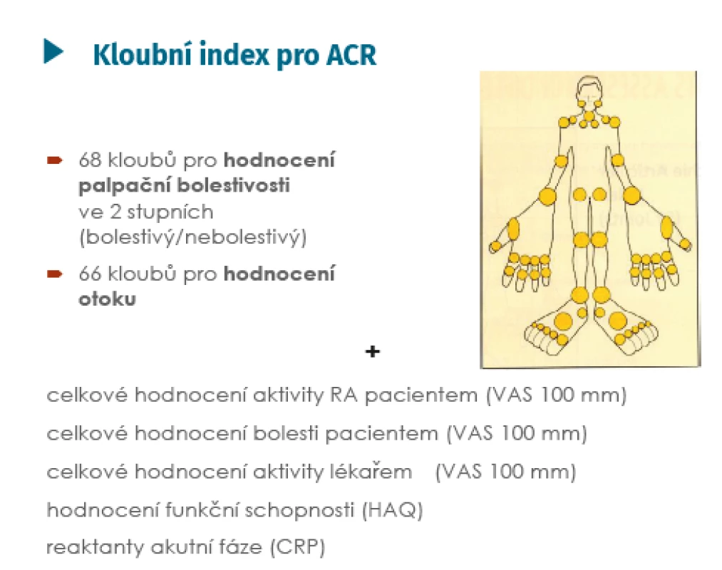 Hodnocení aktivity onemocnění podle indexu ACR<br>
(American College of Rheumatology) (Gossec L, et al. Ann Rheum
Dis 2009; 68(11): 1680–1685 a Gossec L, et al. Ann Rheum Dis 2011;
70(6): 935–342)