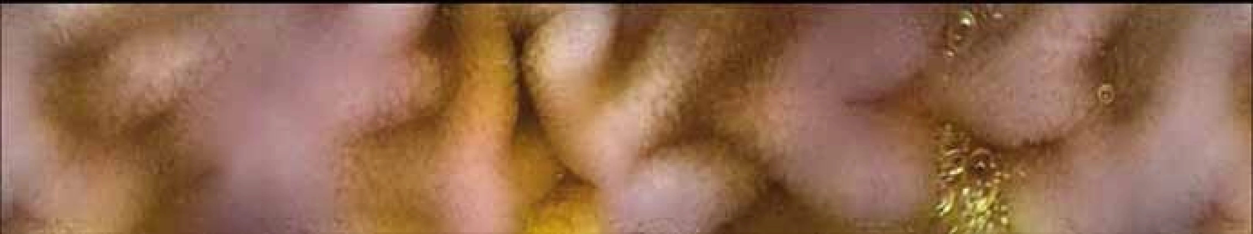 Normální endoskopický nález v duodenu, prase domácí – kapslová endoskopie.<br>
Fig. 1. Normal endoscopic findings in the duodenum, domestic pig – capsule
endoscopy.