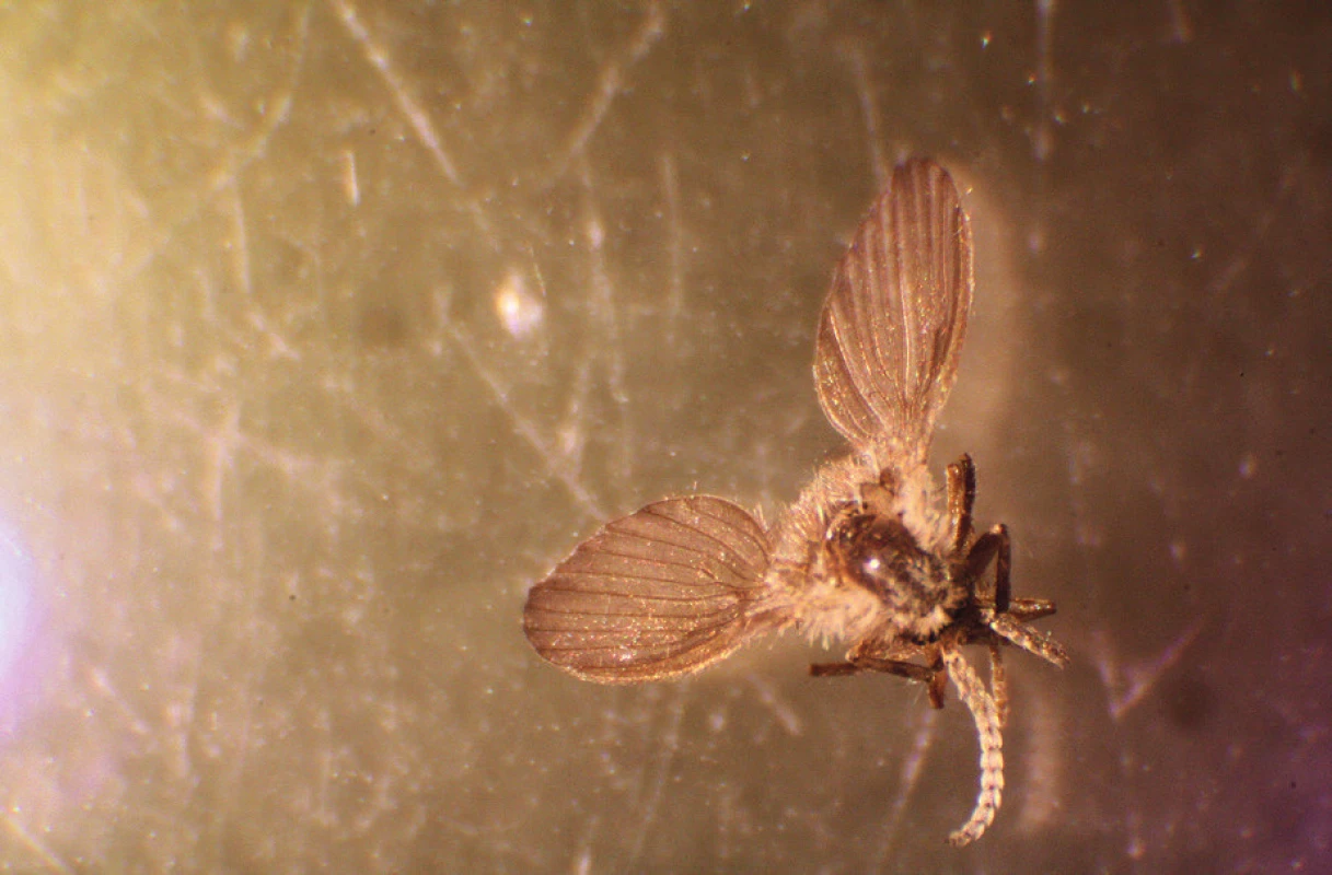 Detail těla Clogmia albipunctata pod stereomikroskopem –
zvětšení 60krát (foto: Pijáček)<br>
Figure 2. Detail of the body of Clogmia albipunctata under
a stereomicroscope (at a magnification of 60 x) (foto: Pijáček)