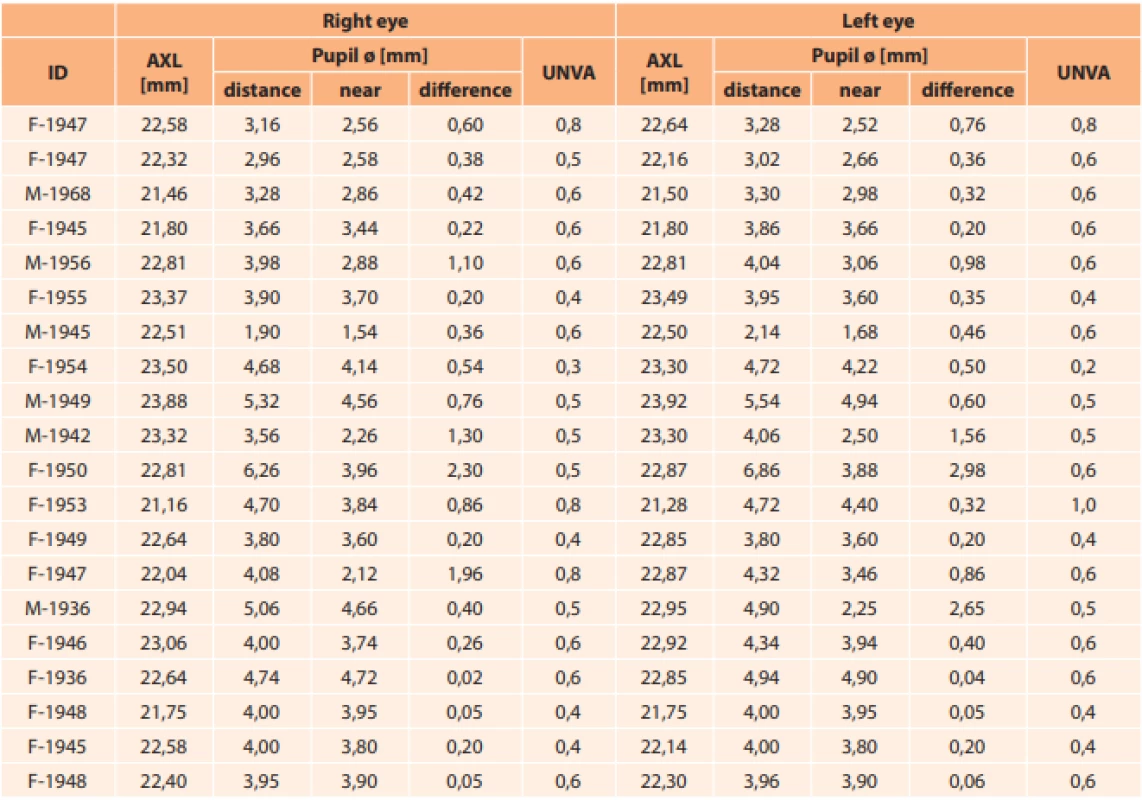 Summary measured data (AXL – eye length, Ø – pupil width, UNVA – uncorrected near visual acuity).