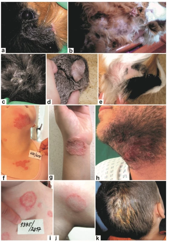 Klinický obraz infekcí způsobených Trichophyton benhamiae u morčat a člověka