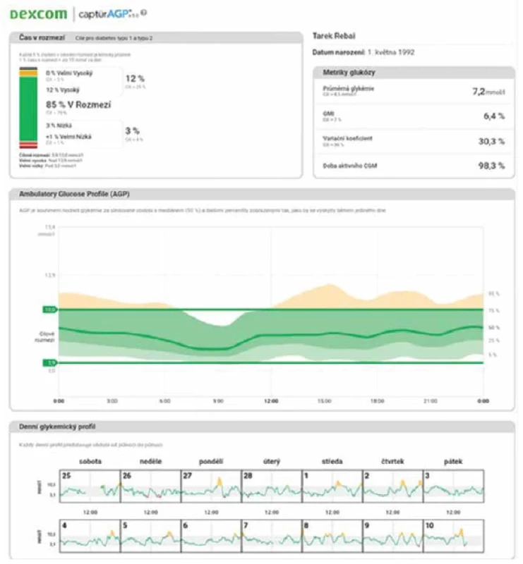 Příklad AGP z kontinuální monitorace pomocí Dexcom G6