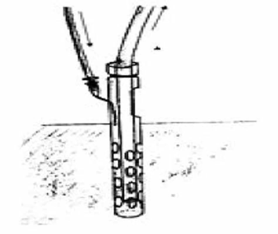 Modifikovaný srkavý drén (vlastný archív)<br>
Fig. 3: Modified sump drain (custom archive)
