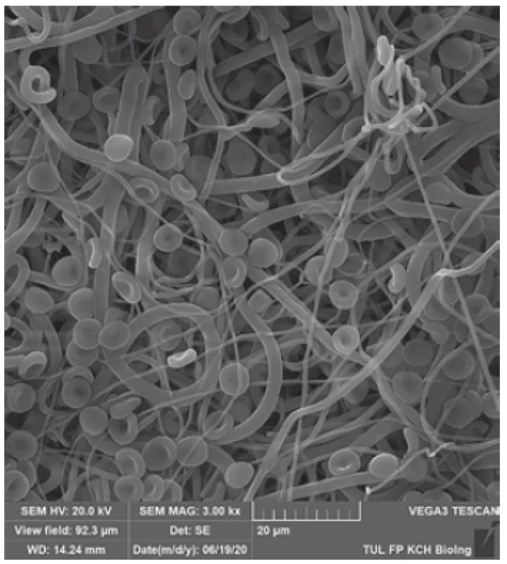 Scanning electron microscope images of erythrocytes
in contact with PLCL electrospun material