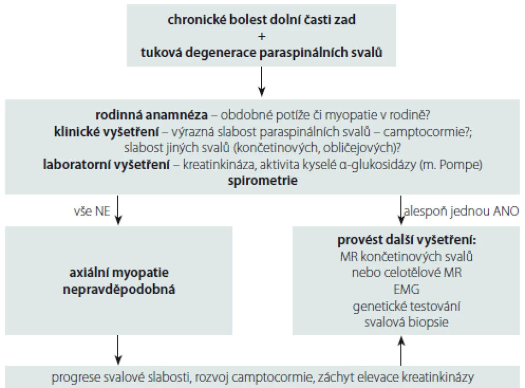 Diagnostický postup při chronických bolestech dolní části zad spojených s tukovou
degenerací paraspinálních svalů k vyloučení přítomnosti axiální myopatie.<br>
Fig. 4. Diagnostic algorithm for chronic low back pain associated with degeneration of
paraspinal muscles to exclude the presence of axial myopathy.