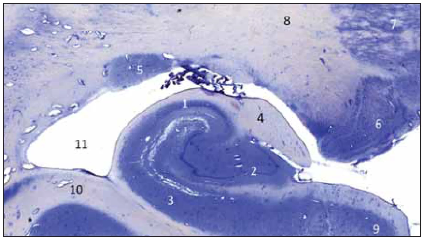 Frontální řez zadní částí hippokampální formace vpravo; Nisslovo barvení
kresylvioletí. <br>
Fig. 1 Frontal section of the posterior part of the hippocampal complex on the right
side; Nissl staining by cresyl violet.