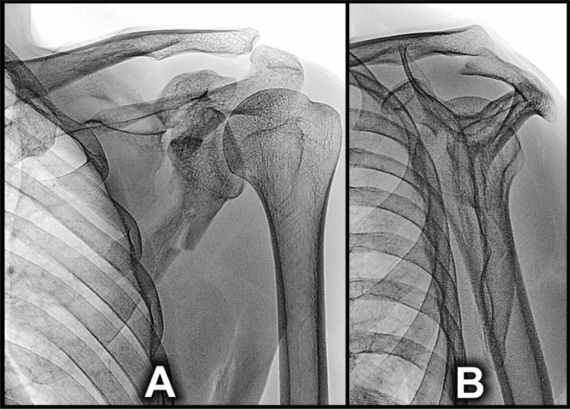 A+B postinjury radiographs