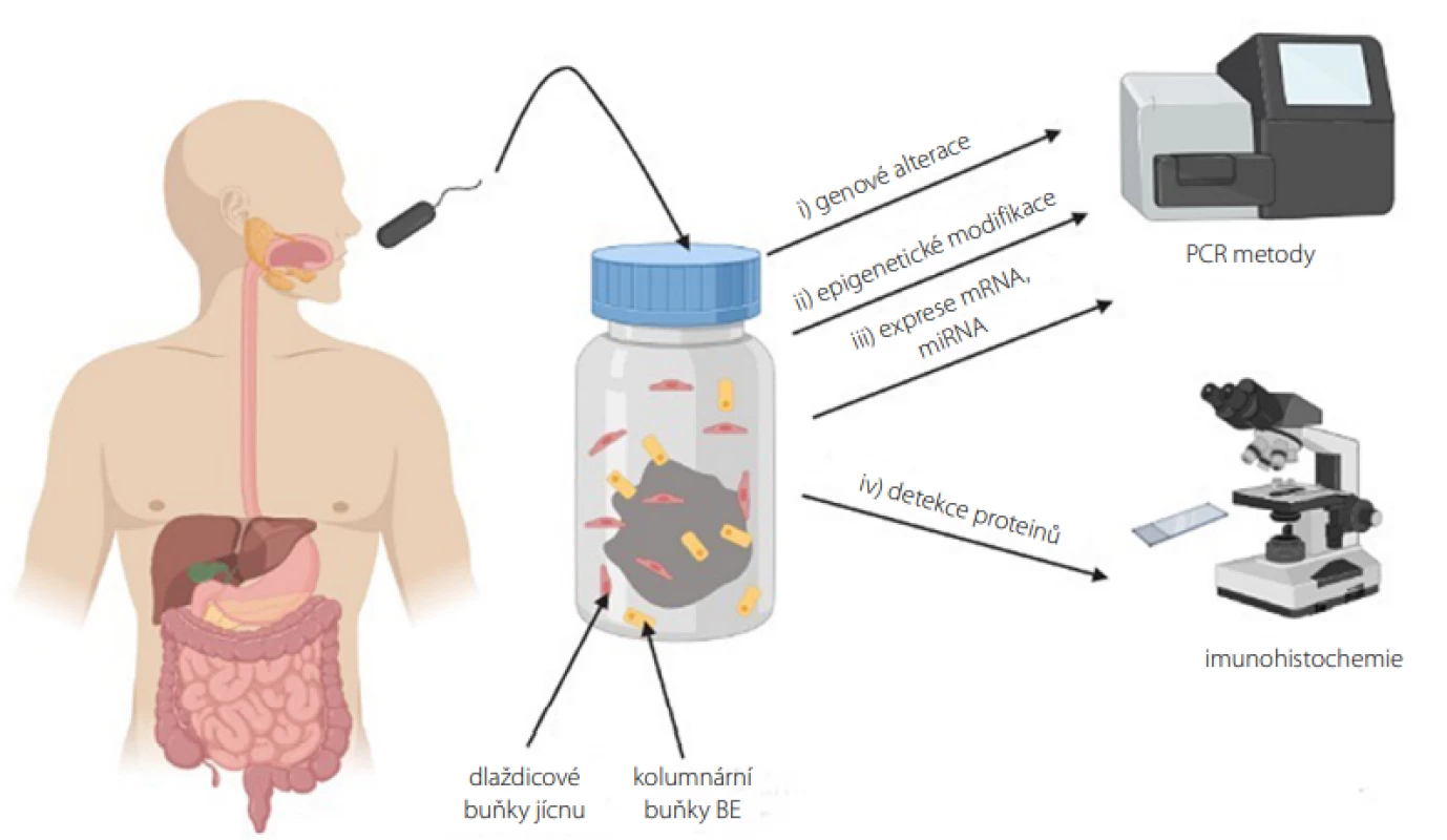 Vyšetření biomarkerů ve vzorku jícnové sliznice získaných neendoskopickou metodou (vytvořeno pomocí programu BioRender.com)