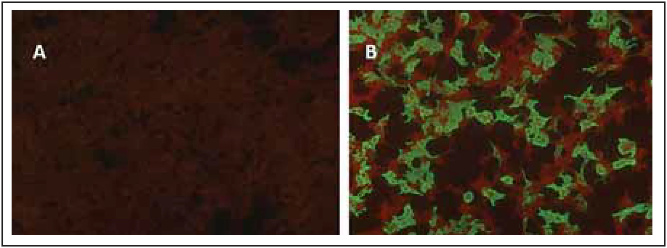Cell-based assay, kde jsou HEK293 buňky transfekovány plazmidem kódujícím
MOG.<br>
Fig. 4. Cell-based assay for MOG-IgG.