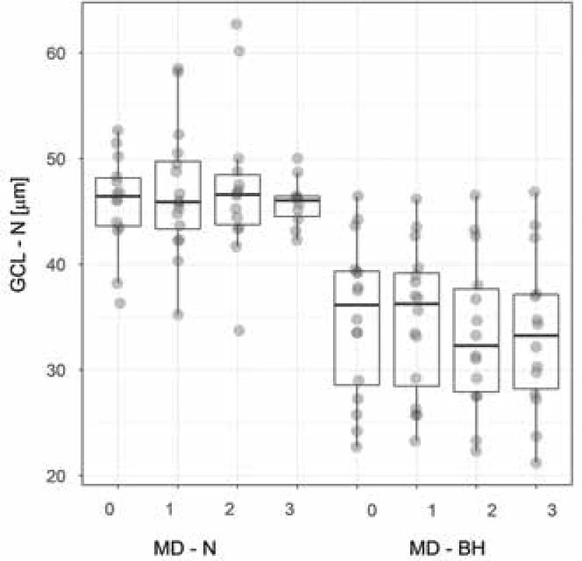  Tloušťka nazální vrstvy GCL u pacientů s, resp.
bez bitemporální hemianopie. Boxplot vyznačuje medián,
dolní, horní kvartil a maximální/minimální hodnoty, ne
však více než 1,5 mezikvartilového rozpětí. Hodnoty
jsou rozmítány, aby bylo vidět množství překrývajících se
hodnot.<br>
Zkratky: GCL - N – vrstva nazálních gangliových buněk,
MD - N, resp. - BH – mean deviation zorného pole u pacientů s, resp. bez, bitemporální hemianopie, 0 – předoperační vyšetření, 1, 2, resp. 3 – první, druhá, resp. třetí
pooperační kontrola