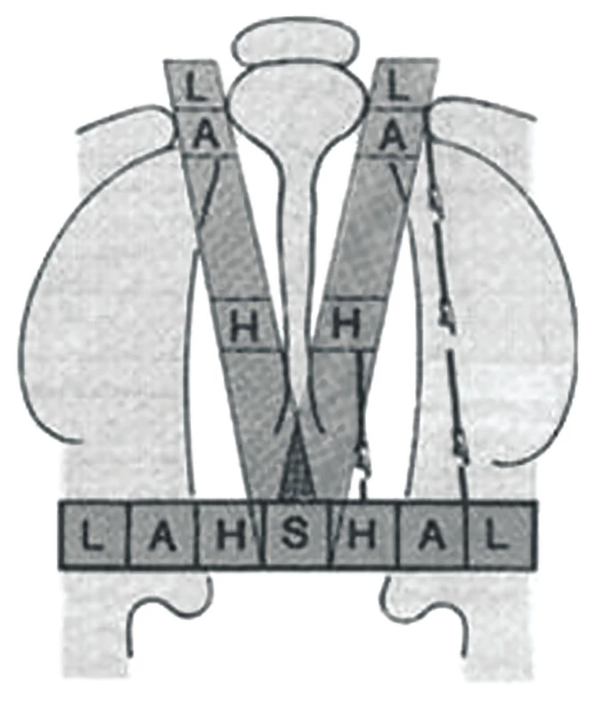 Schematic visualization of the Kriens classification LAHSHAL [5].<br>
Capital letter means complete cleft, lowercase letter an incomplete cleft.<br>
L – lip right, A – alveolus right, H – hard palate right, S – soft palate (median), hard palate left – H, alveolus left – A, lip left – L.
