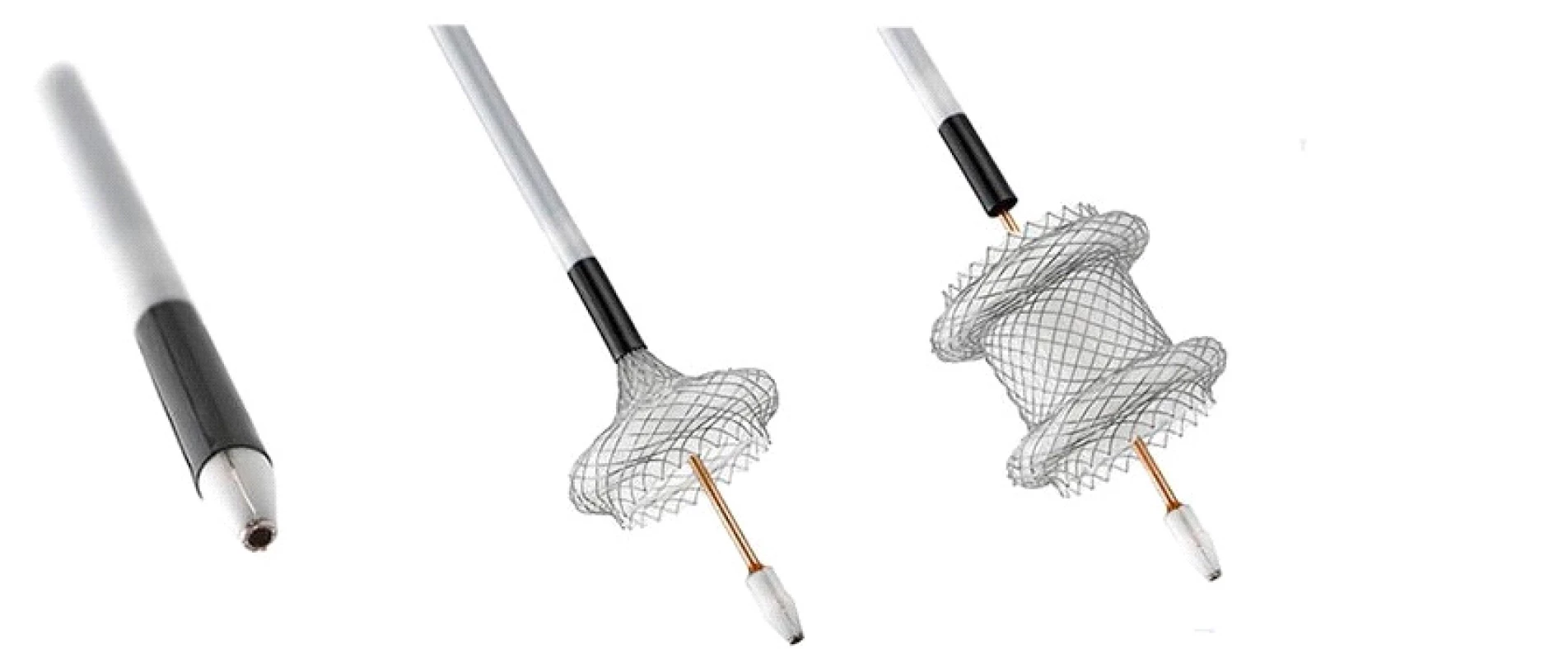 Metalický apoziční stent – Hot AXIOS<br>
Fig. 2: Lumen apposing metal stent – Hot AXIOS