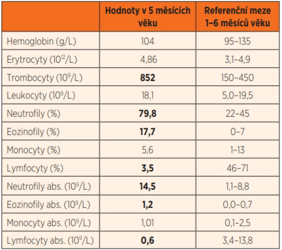 Krevní obraz s diferenciálním rozpočtem leukocytů pacienta
s RAG2 SCID ve věku 5 měsíců (tučně zvýrazněny hodnoty
mimo referenční meze).