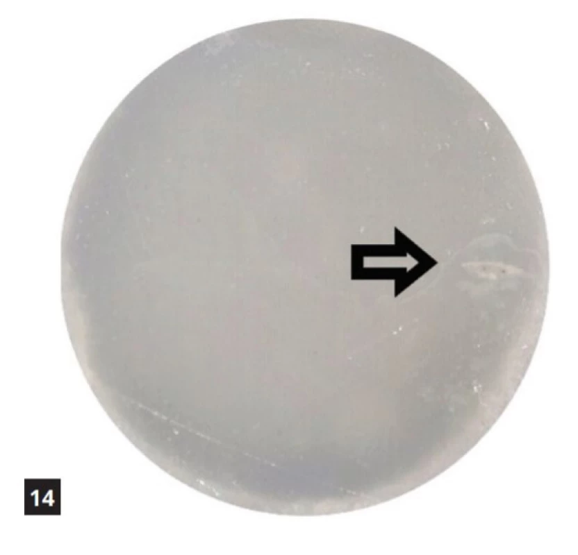 Filtek Ultimate Flow vystavený kyselému pH po dobu 14 dnů<br>
Fig. 14 Filtek Ultimate Flow exposed to acidic pH for 14 days