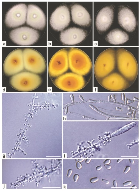 Morfologie zoofilního druhu
Trichophyton erinacei