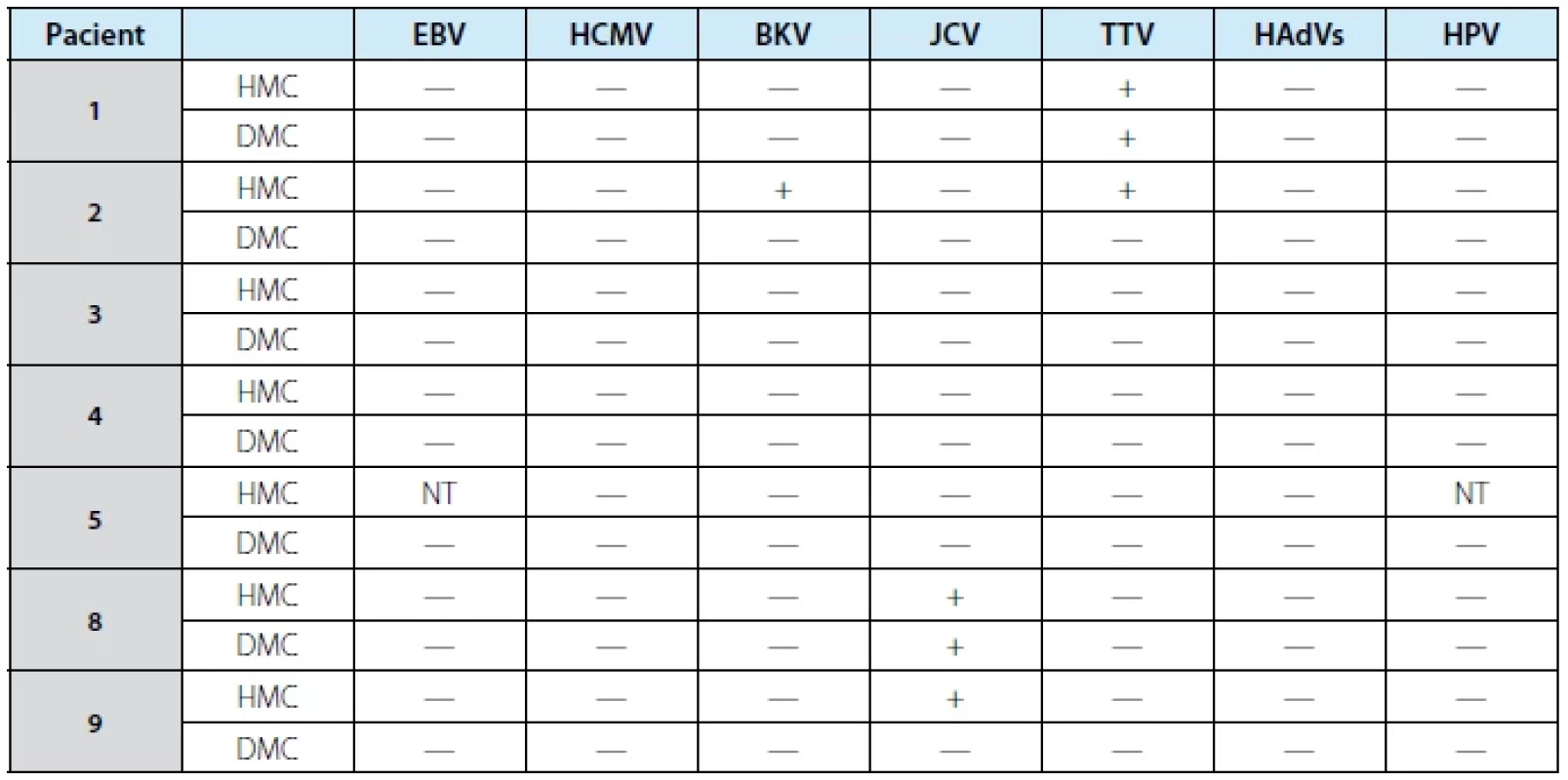 Detekce nukleových kyselin vybraných DNA virů ve vzorcích moči z horních a dolních močových cest.
HMC horní močové cesty DMC dolní močové cesty, EBV virus Epsteina a Barrové, HCMV lidský cytomegalovirus,
BKV BK polyomavirus, JCV JC polyomavirus, TTV torque teno virus, HPV lidský papillomavirus, HAdVs adenovirus,
NT netestováno. <br> 
Tab. 1. The detection of viral nucleic acids in the upper and lower urinary tract. EBV Epstein-Barr virus, HCMV
human cytomegalovirus, BKV BK polyomavirus, JCV JC polyomavirus, TTV torque teno virus, HPV human papillomavirus,
HAdVs human adenovirus, NT not tested.