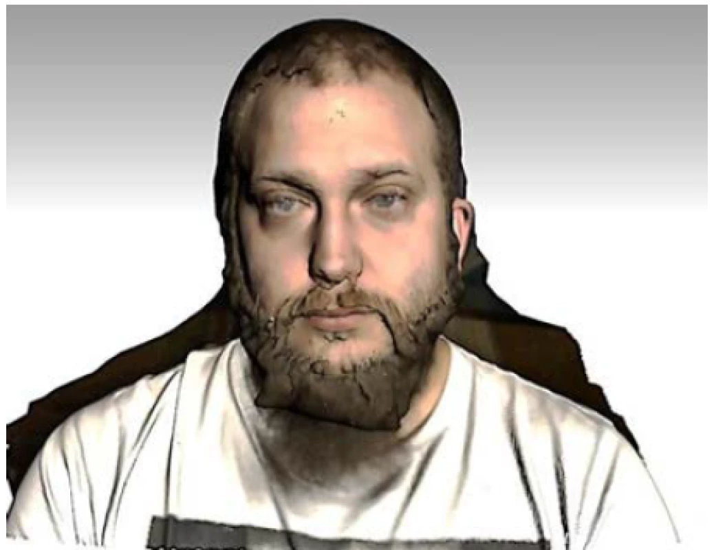 Shooting eyes and thick beard.