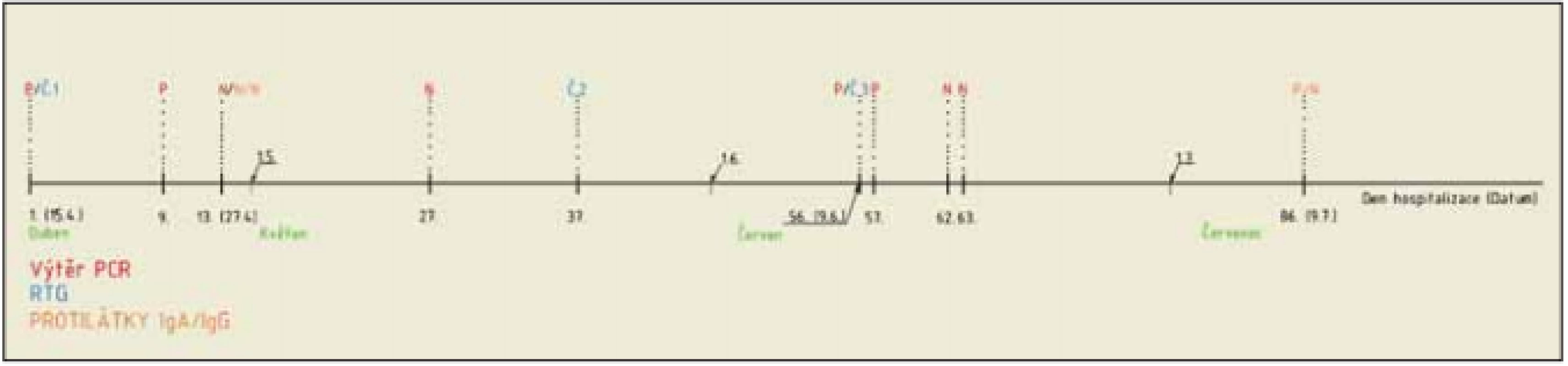Časová osa ukazující průběh onemocnění pacientky s výsledky vyšetření PCR a serologických vyšetření.<br>
Fig. 2. Timeline showing the course of the patient‘s disease with the results of PCR and serological examinations.