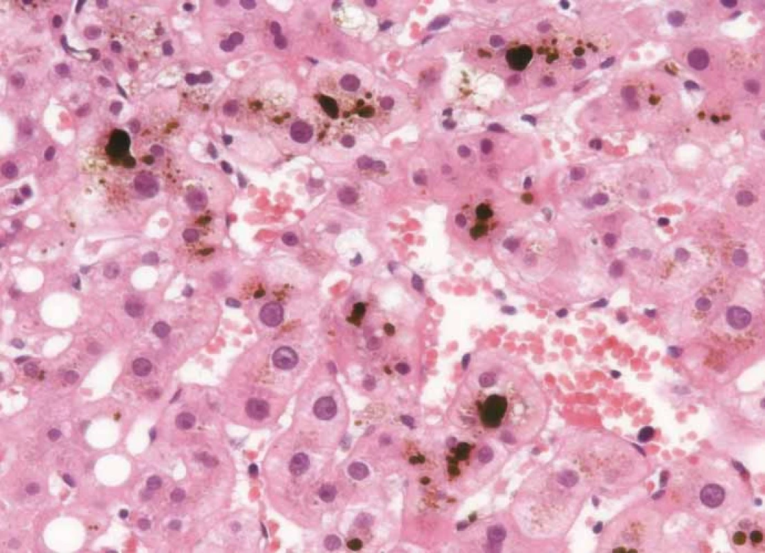 Histological samples of liver tissue.
