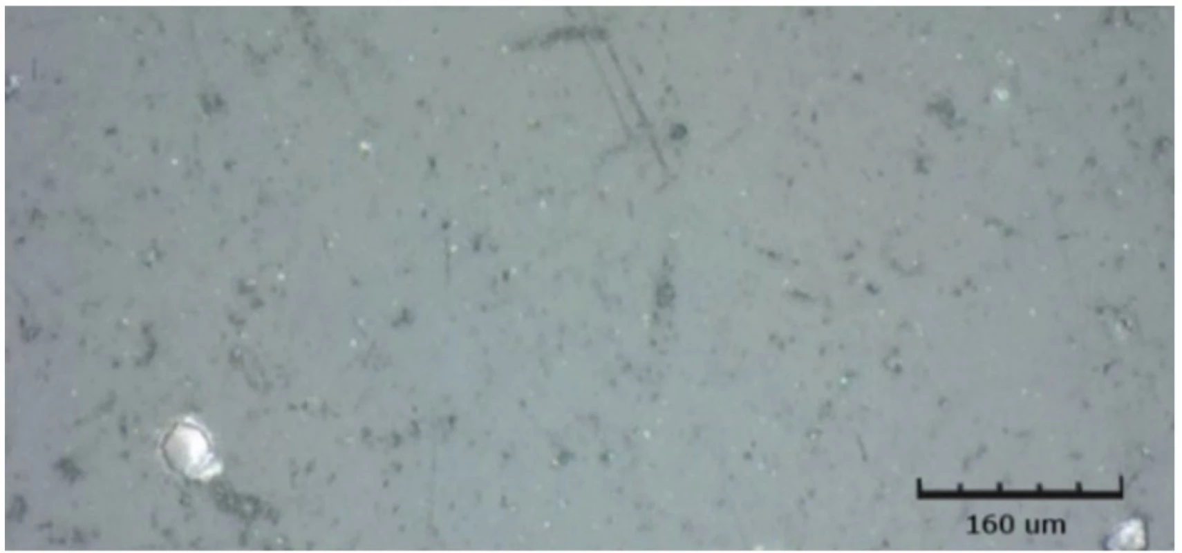 Kontrolní vzorek Filteku Ultimate ve vodě, zobrazeno CLSM <br>
Fig. 11 Filtek Ultimate in water sample, shown by CLSM