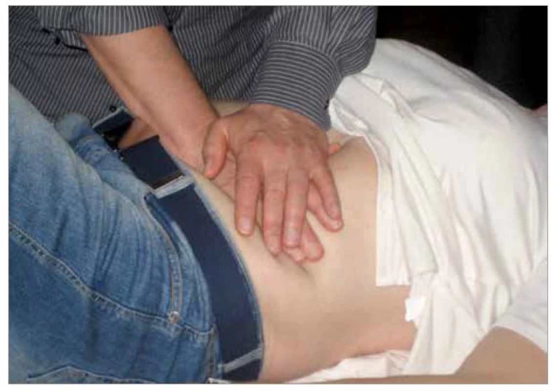 Ošetření gastrofrénického ligamenta (zdroj: autor).<br>
Fig. 3. Treatment of the gastrophrenic ligament (source: author).