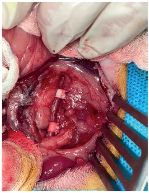 Arterial bands on rabbit subrenal aorta