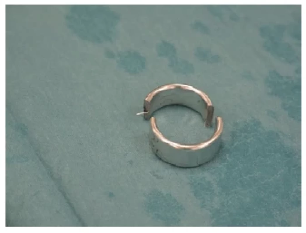 Přerušený kovový prsten <br> 
Fig. 5. The metallic ring cut in two pieces