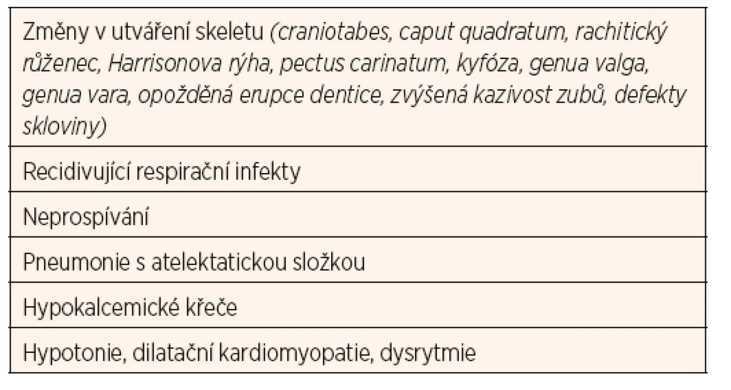 Klinické známky rachitidy.