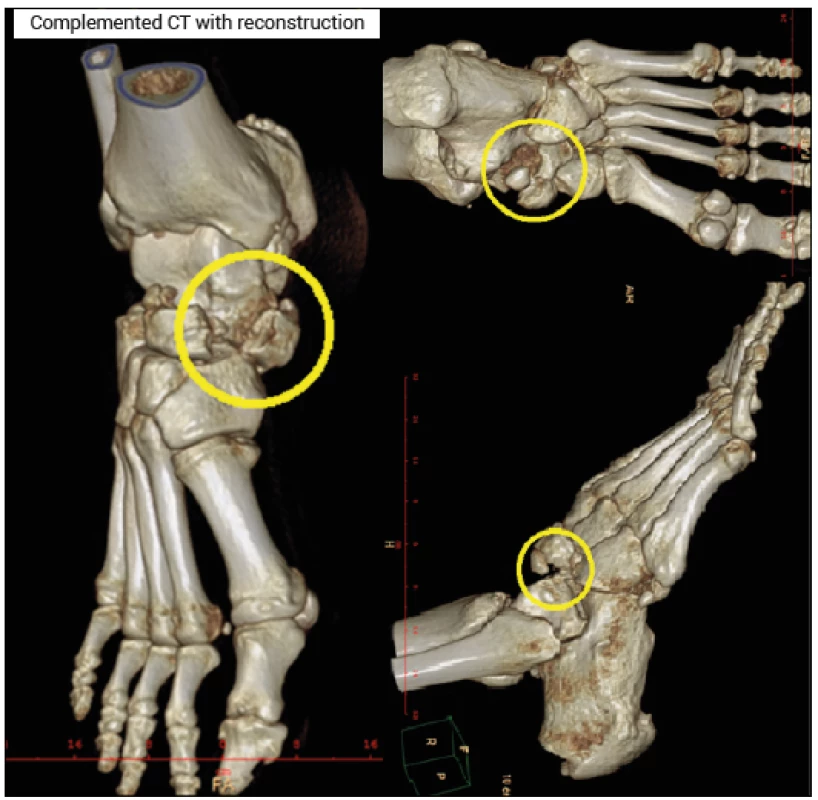 Completed CT with reconstruction (Sedlář Archive)