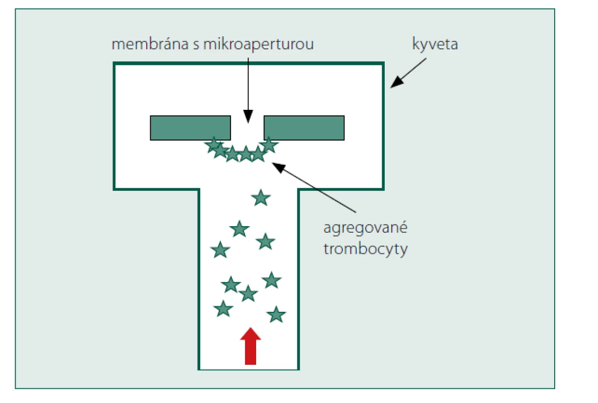 Princip přístroje Innovance PFA-200