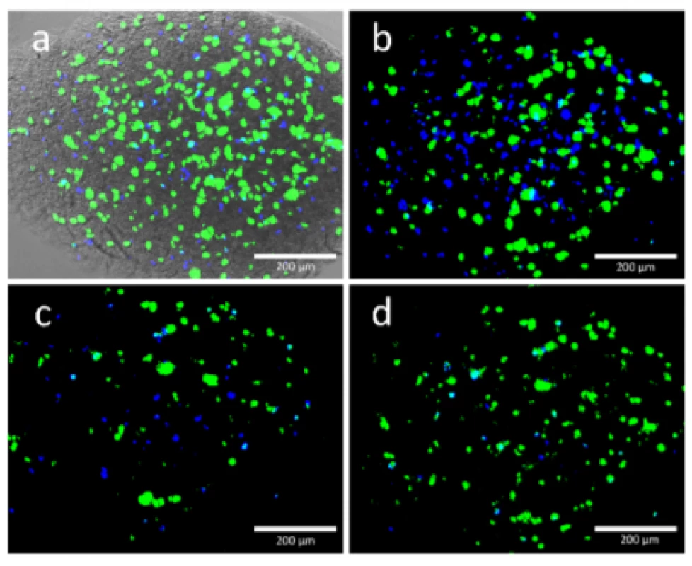  Viable (green) and dead (blue) HEK cells were
found in the printed structure. Each image shows the
same position of a scaffold printed with 50 kPa. Images
were taken at 0 DAP, 3, DAP, 6 DAP and 10 DAP and
they are matching the alphabetic order of the figures.
Image a) was merged with a transmitted light image to
get an impression at the scaffold.