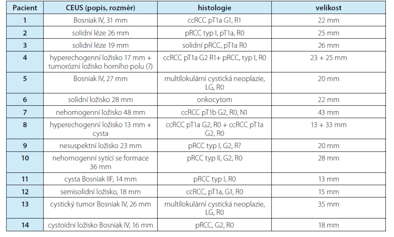 Korelace nálezu CEUS s histopatologickým závěrem u pacientů po laparoskopické resekci ledviny<br>
Tab. 1. The correlation of CEUS findings with histopathological results in patients after laparoscopic nephron
sparing surgery