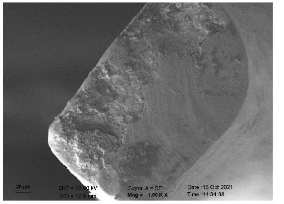 Lomná plocha
endodontického nástroje
po testu cyklické únavy
při zvětšení 1000x ve
skenovacím elektronovém
mikroskopu<br>
Fig. 1
Fracture plane of an
endodontic instrument after
cyclic fatigue test at 1000x
magnification by scanning
electron microscopy