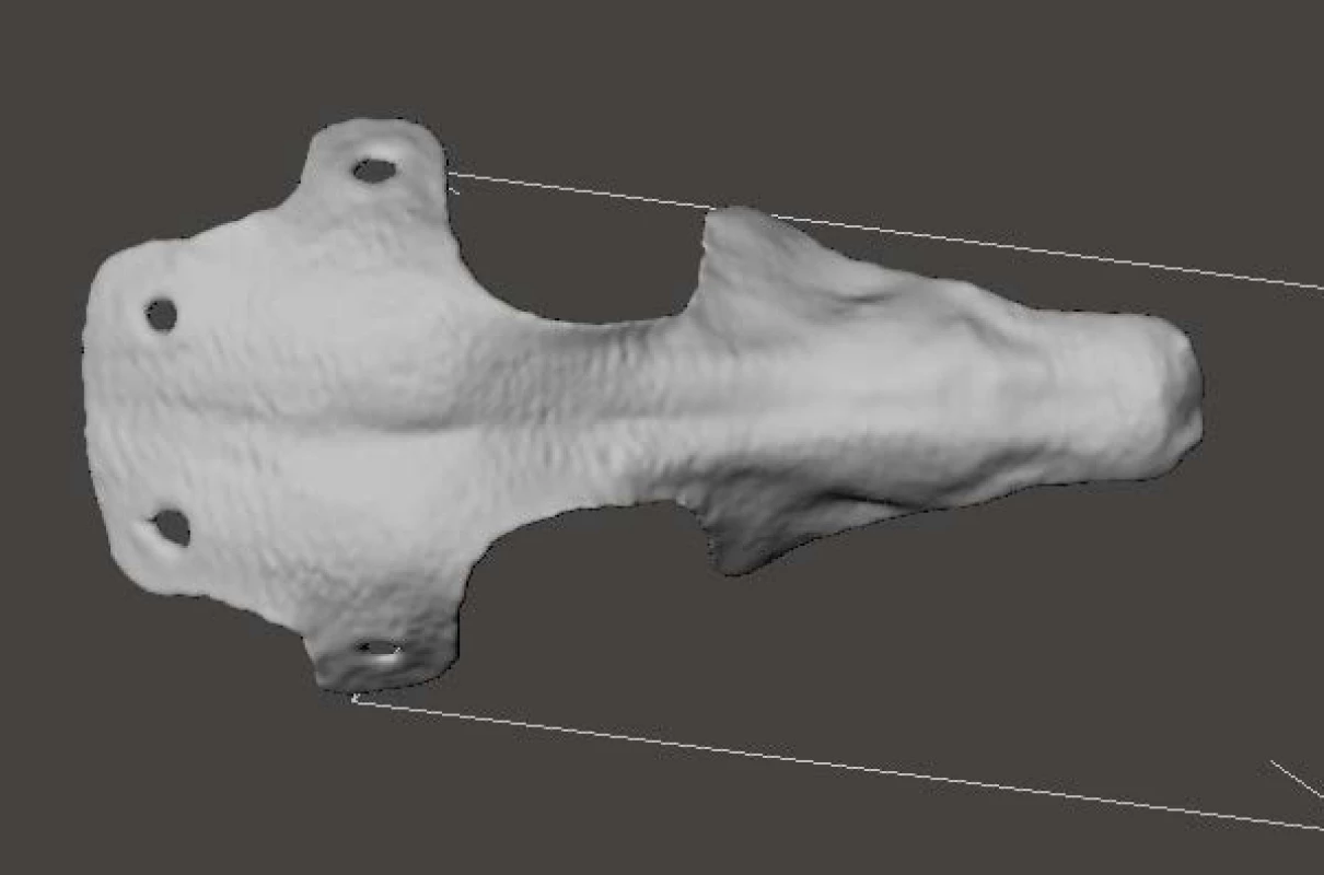 The final model.
Material and production by additive