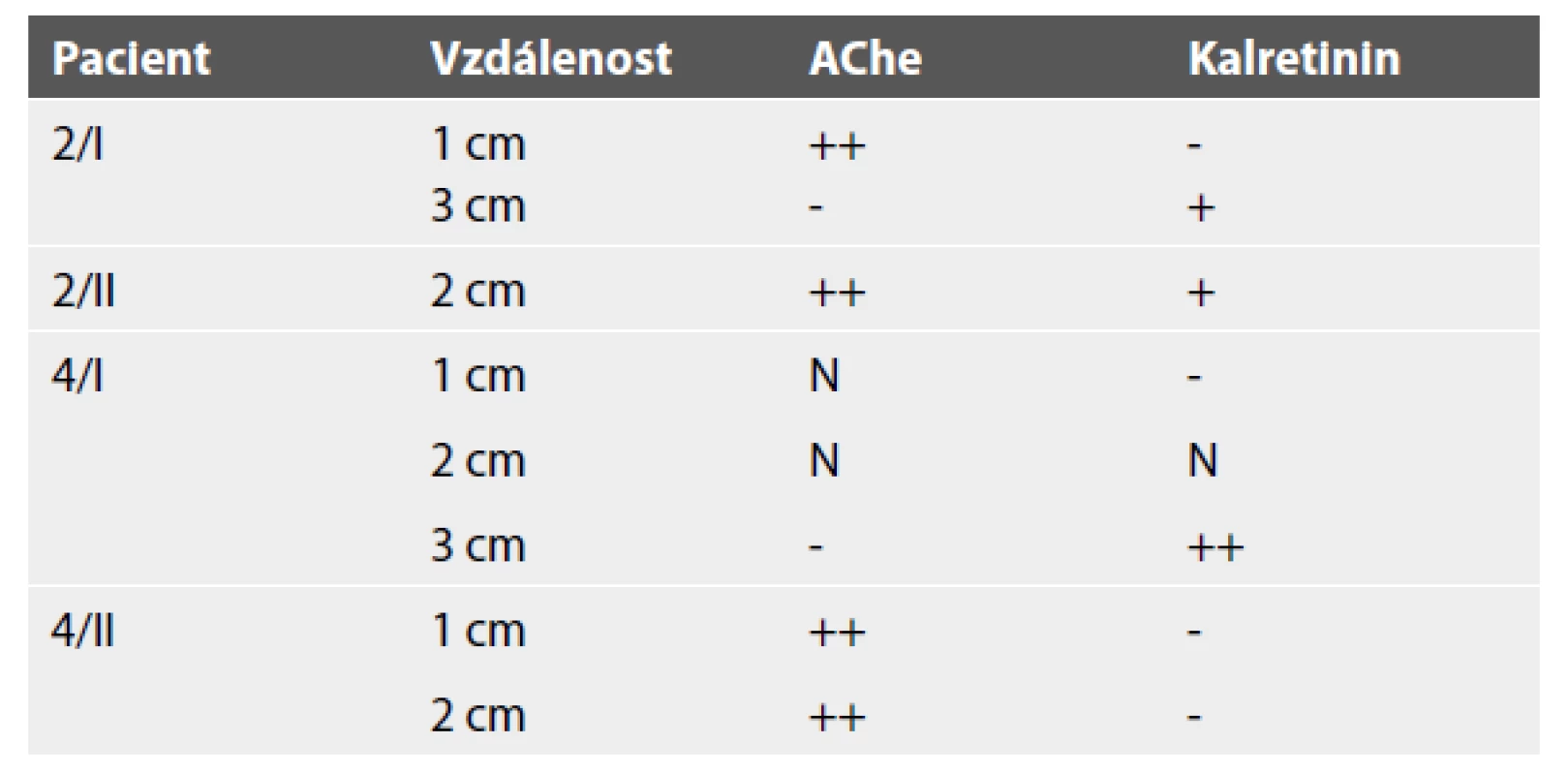 Případy diskrepance mezi histochemickým a imunohistochemickým
vyšetřením.
Pacient Vzdálenost