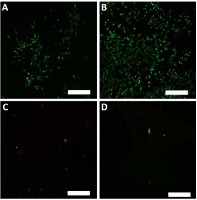 Vital staining of melanocytes seeded on the
nanofibrous scaffolds on day 8. Viable cells are green
(BCECF-AM), dead cells are red (propidium iodide).
A – PCL, B – PCL/PL, C – PVA, D – PVA/PL. Magnification 100×, scale bar 200 µm.