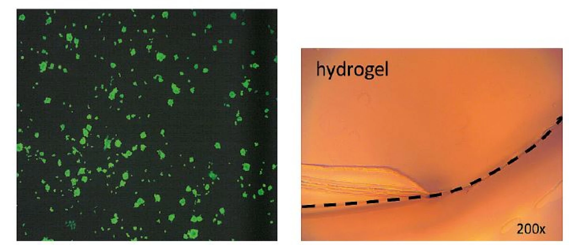 Viability of mouse 3T3 fibroblasts under a fluorescence microscope and a peel-off test of hydrogel adhesion to keratinocytes