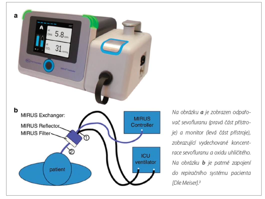 MIRUSTM Controller